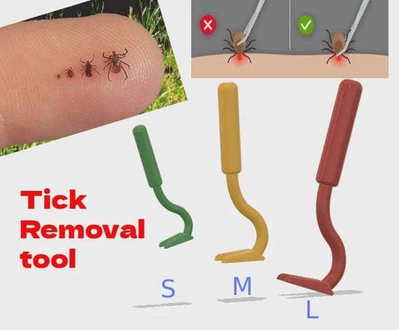 Tick Remover Tool: 3 Sizes Included thumbnail 2