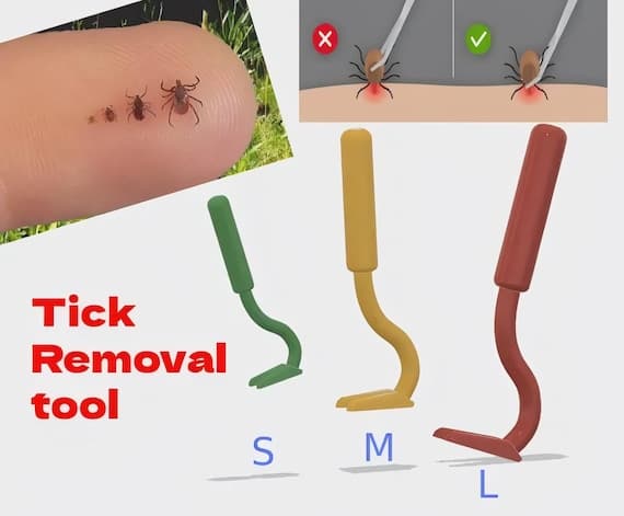 Tick Remover Tool: 3 Sizes Included